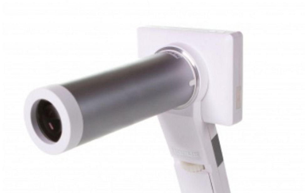digital ophthalmoscope